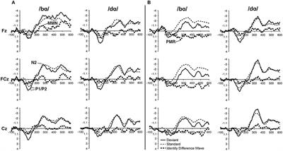 Evidence for [Coronal] Underspecification in Typical and Atypical Phonological Development